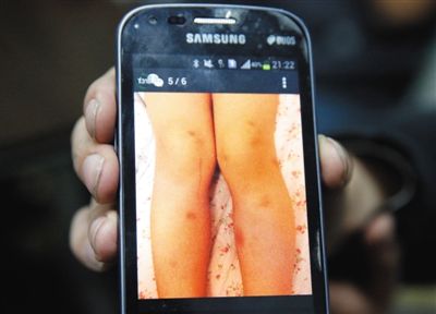 北京1所幼兒園21名兒童長期遭女老師毆打-中國教育2